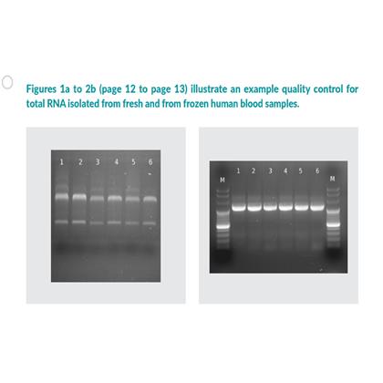 Universal Blood RNA Purification Kit
